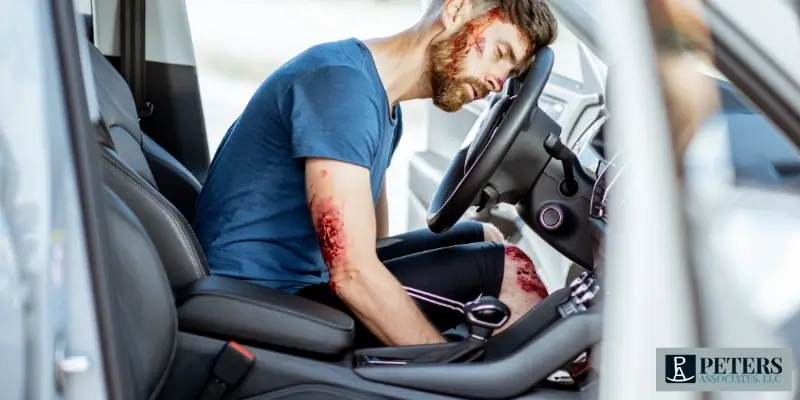 best redmond dui with injury attorney